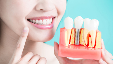 Who Is A Candidate For Dental Implants