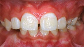 Ortho 03 After.jpg