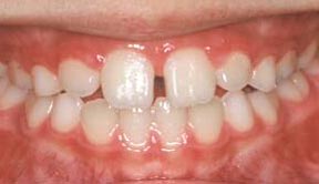 Ortho 04 After.jpg