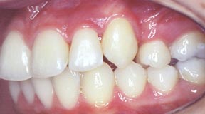 Ortho 06 After.jpg