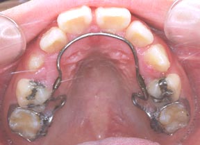 Ortho 08 After.jpg