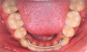 Ortho 09 After.jpg